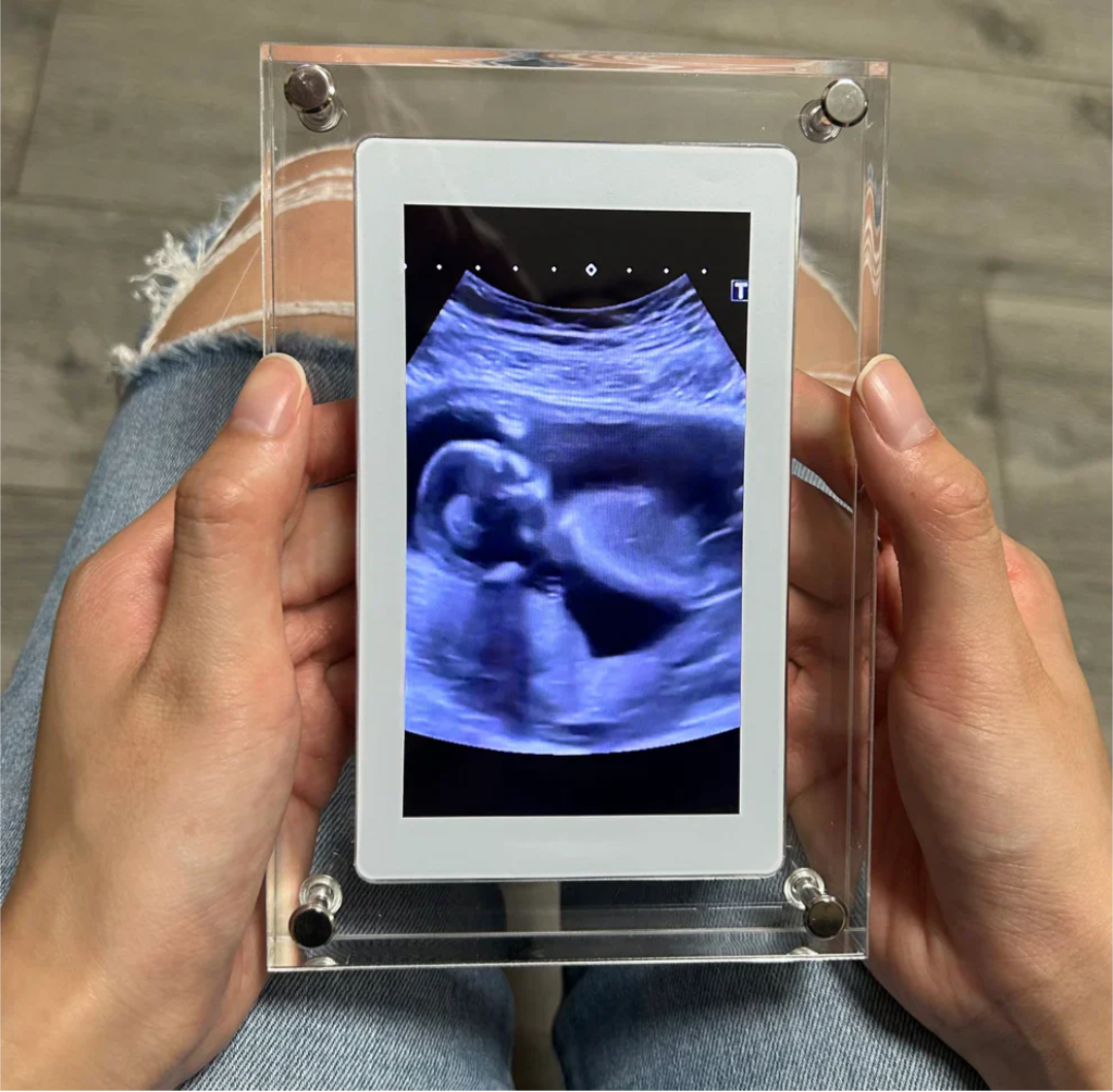Digital frame